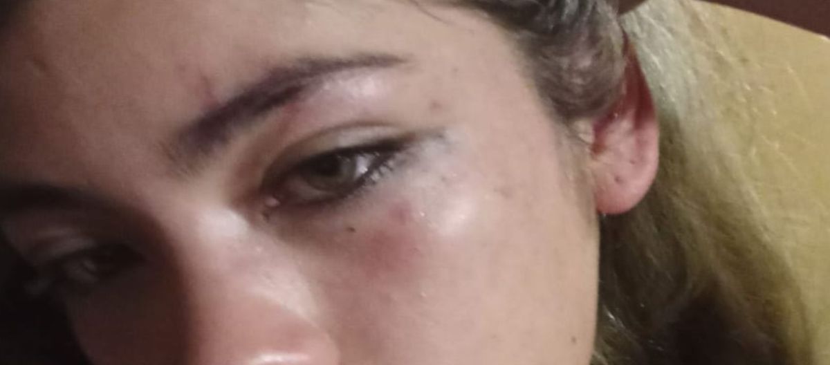 Imagen de la noticia: Violenta pelea captada en video: desfiguraron a una chica en un boliche