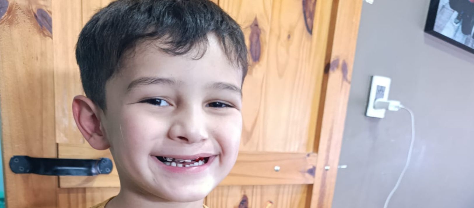 Imagen de la noticia: Un nene de 6 años necesita ayuda para realizarse una cirugía el 13 de diciembre